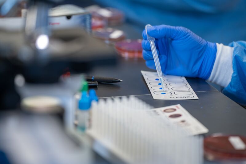 Medical laboratory, hands with dropper testing liquid